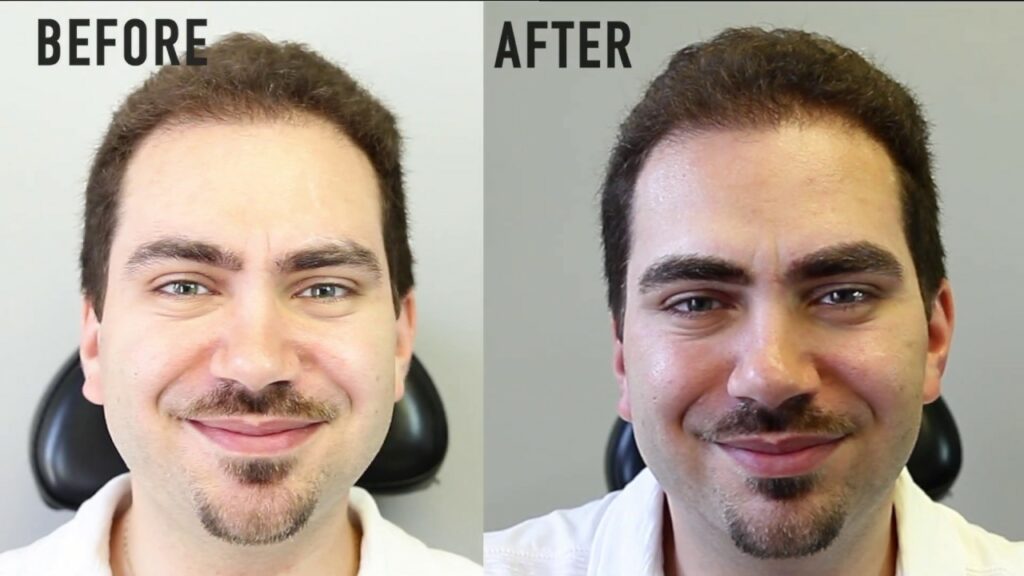 Microblading en hombres