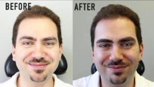 Microblading en hombres