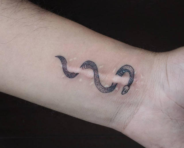 Tatuar cicatrices de la piel