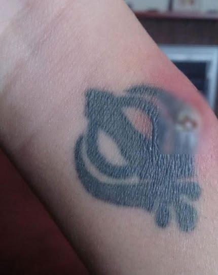 Tatuajes infectados en la muñeca
