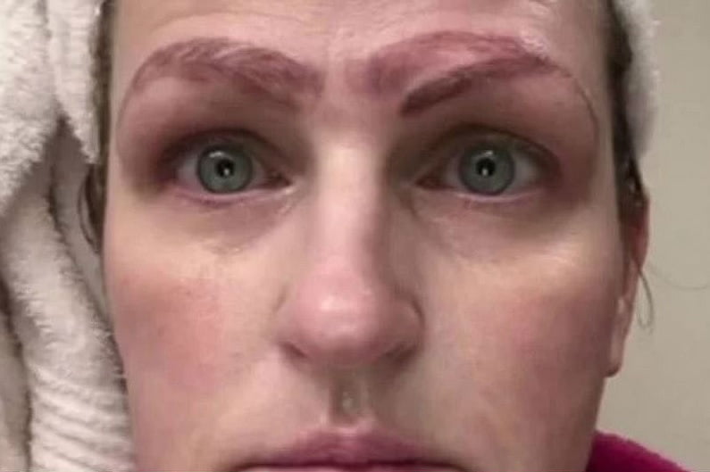 Mujer con cuatro cejas
