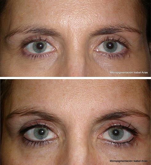 Antes y después de la Micropigmentación de ojos